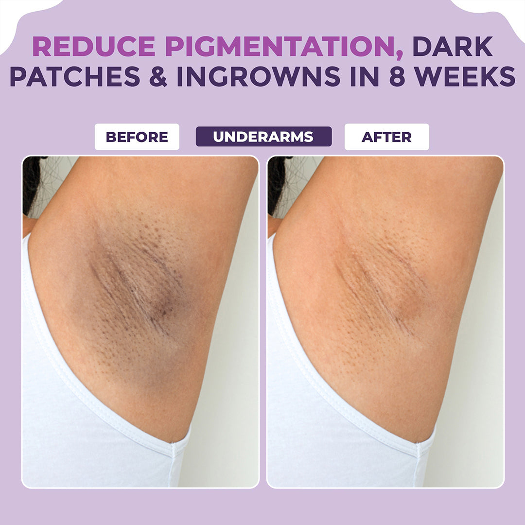 Lightening Serum - 50ml (Pack of 3)