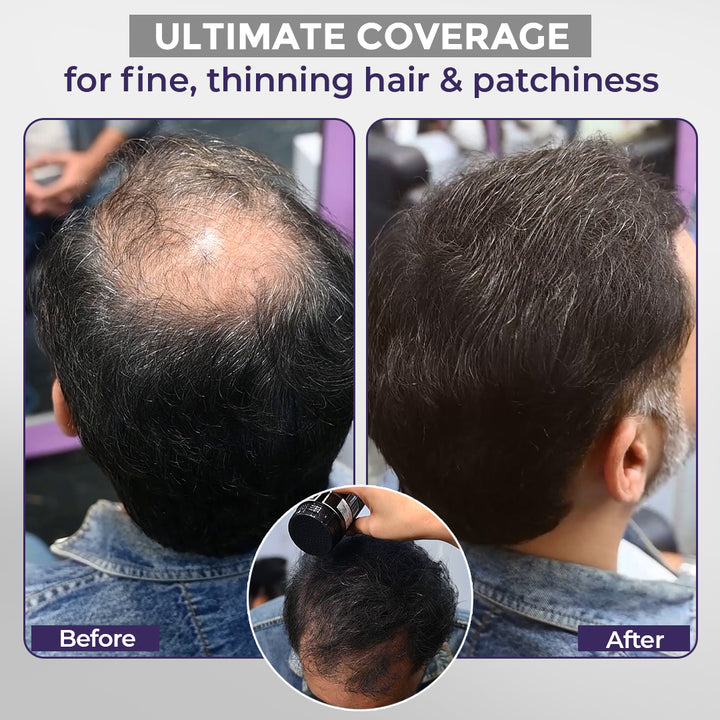 Sanfe Instant Bald Spot Covering Fibers 22gm - Black (M)