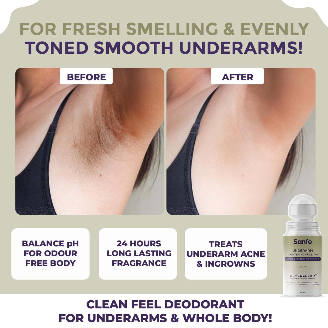 M Underarm Lightening Roll On For Women - Oudh