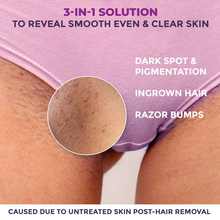 Sensitive Areas Body Scrub - 100gm
