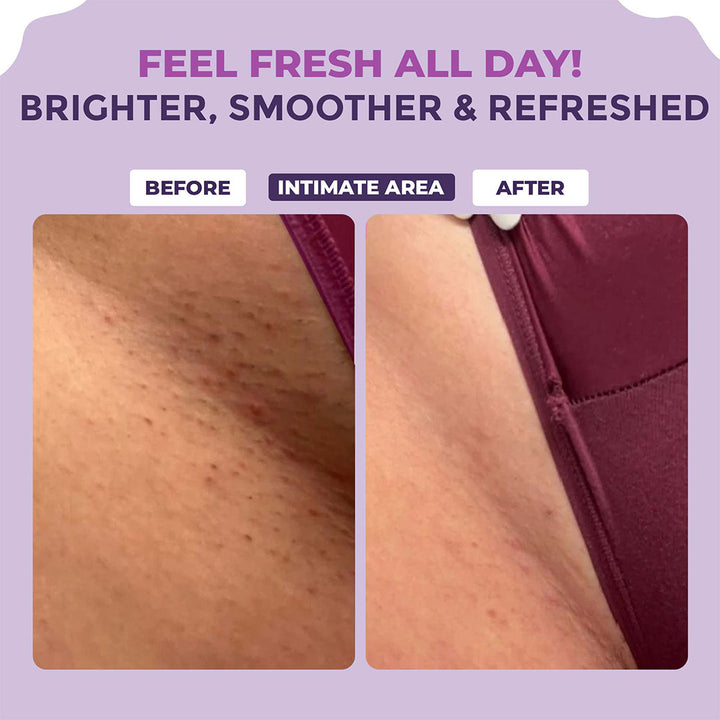 Lightening Serum - 50ml (Pack of 3)