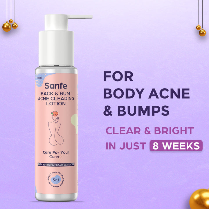 Sanfe Body Acne Clearing Lotion 100ml