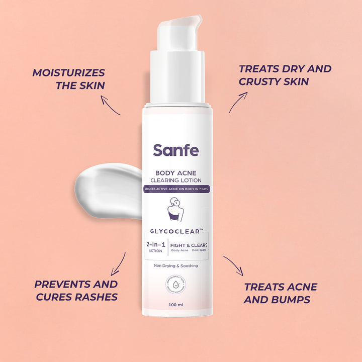 -Sanfe Body Acne Clearing Lotion 100ml