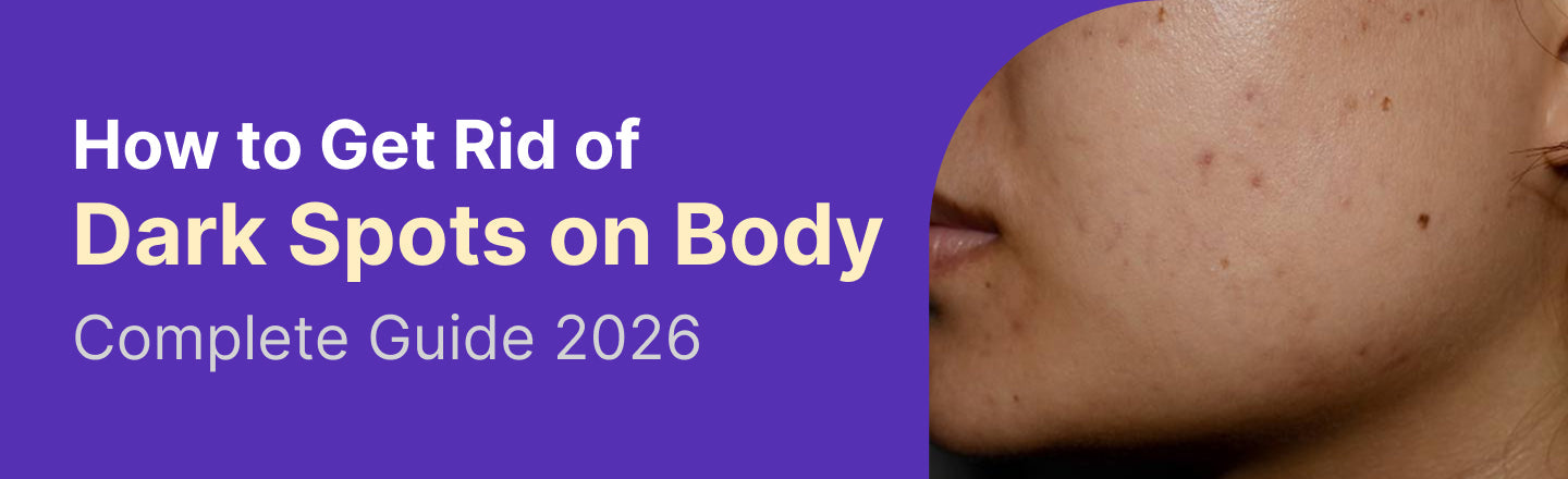 How to Get Rid of Dark Spots on Body - Complete Guide 2026
