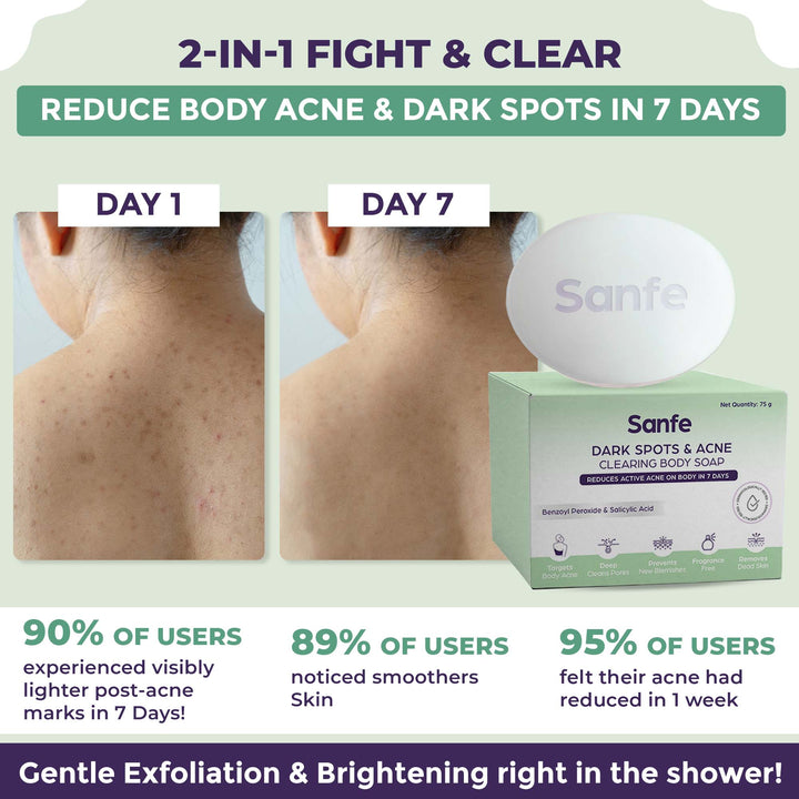 Dark Spots & Acne Clearing Body Soap - Pack of 3