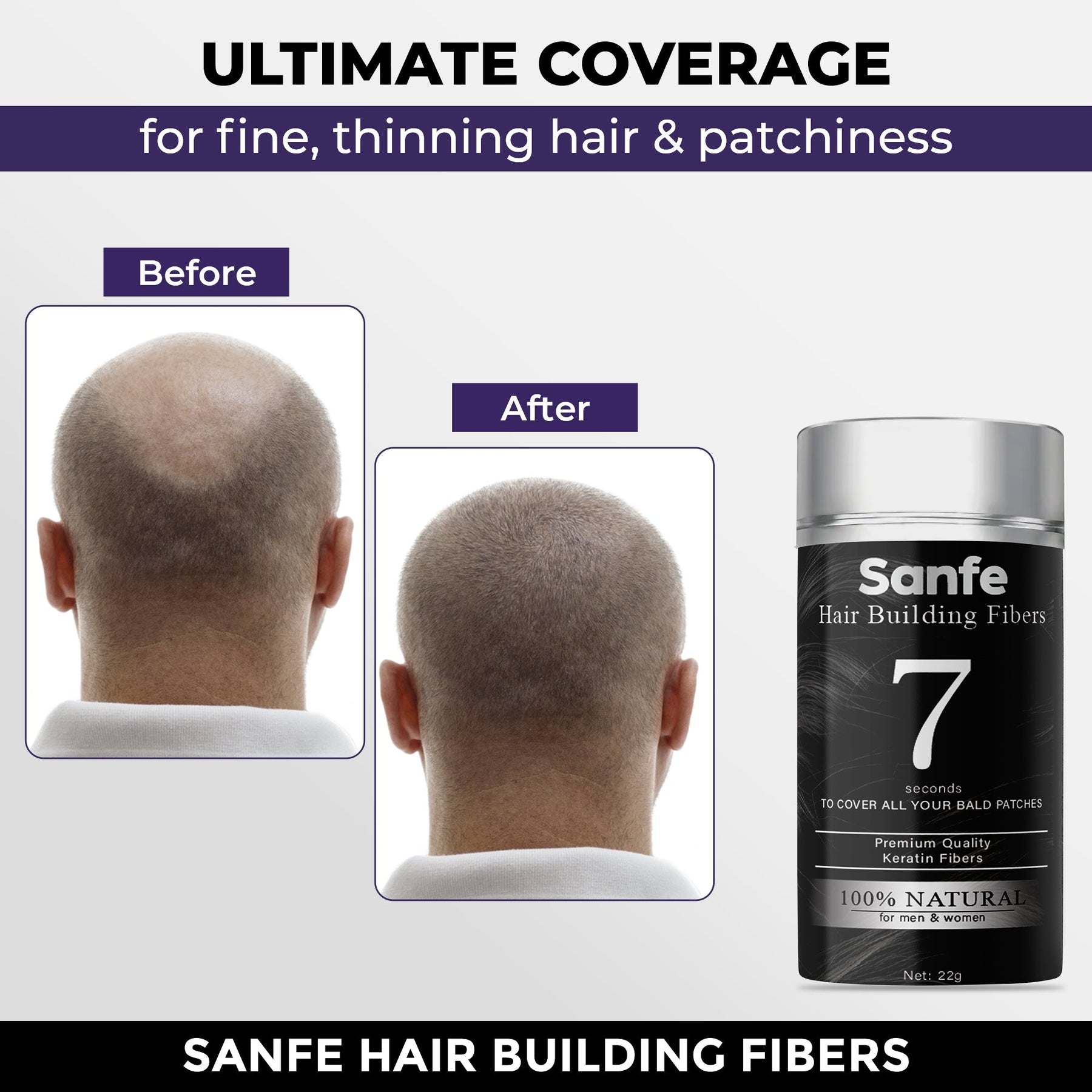 Sanfe Instant Bald Spot Covering Fibers 22gm Black