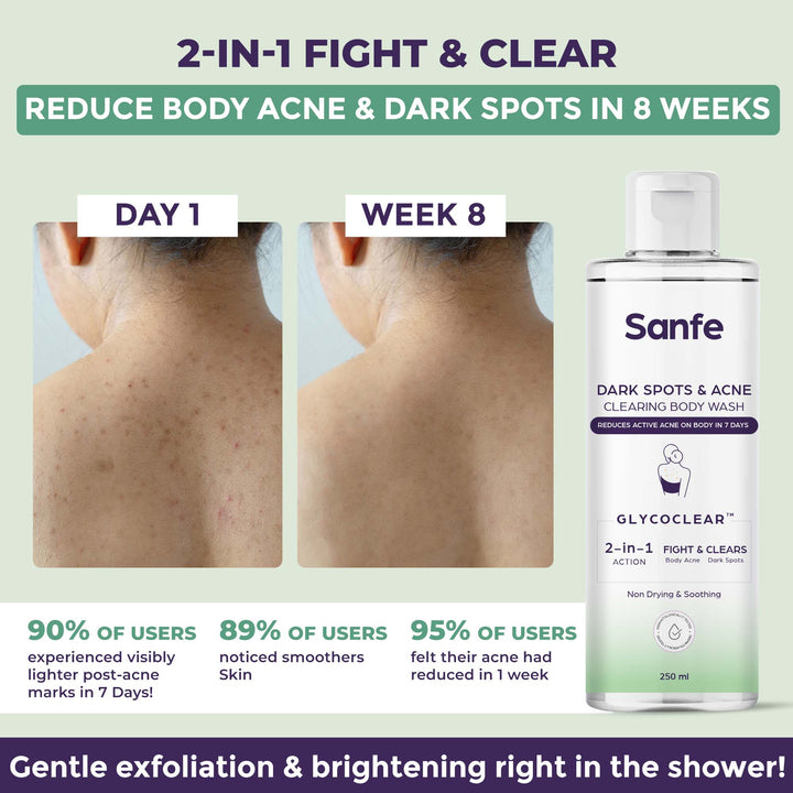 Sanfe Dark Spots & Acne Clearing Body Wash