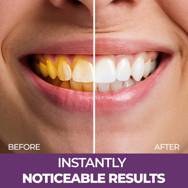 Purple Teeth Whitening Gel