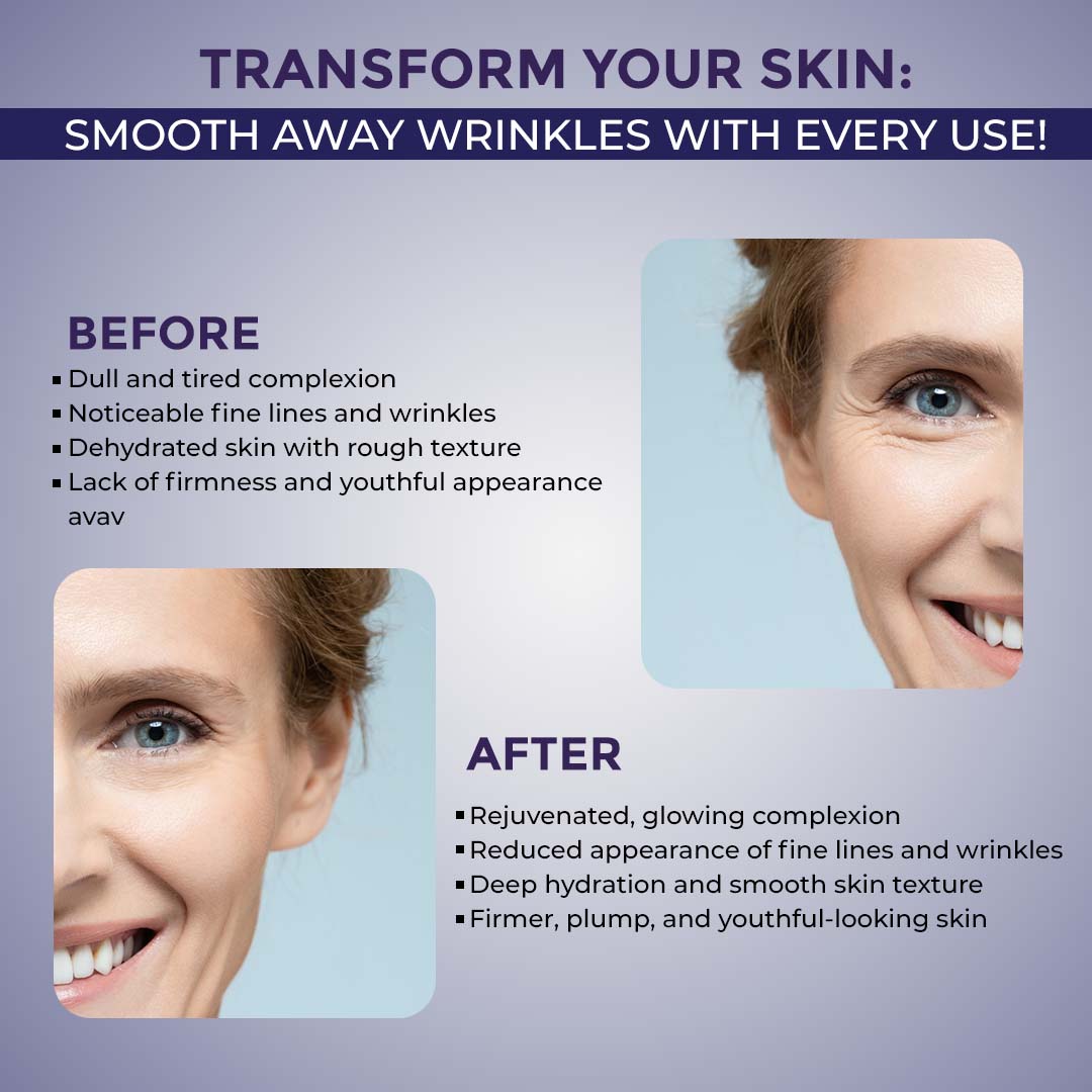 Sanfe Mummy Anti Wrinkle & Lifting Face Mask