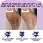 Sanfe 3 Step Underarm Complete Care Kit| Treats Ingrown Hair, Pigmentation & Body Odour| Underarm Lightening Roll On, Spotlite Scrub & Spotlight Serum