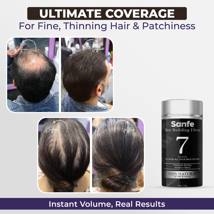 Sanfe 10-Second Hair Transformation Combo