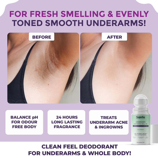 Sanfe Underarm Care Kit | Lightens Pigmentation | Treats Ingrowns | 24-Hour Freshness | Spotlite Scrub & Underarm Lightening Roll On