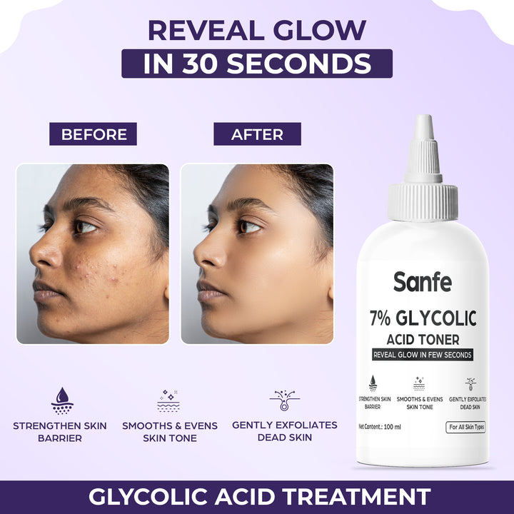 Sanfe 7% Glycolic Acid Toner - 100 ml