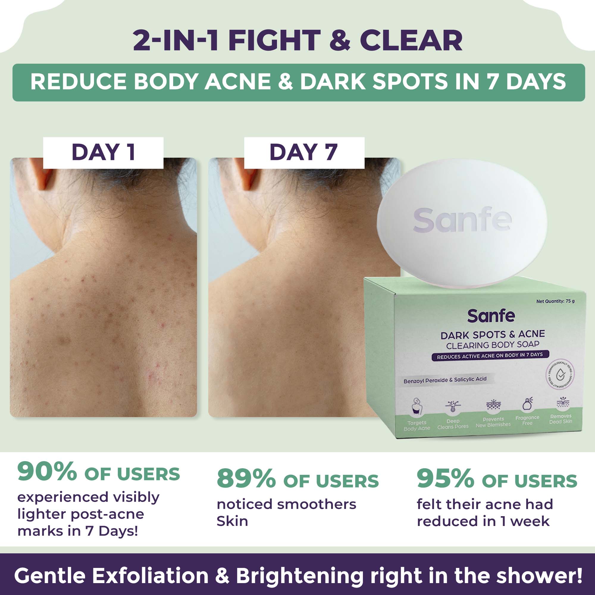 Dark Spots Acne Clearing Body Soap Sanfe