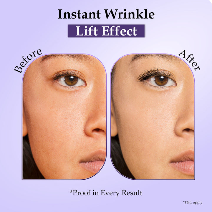 CollagenVita™ Wrinkle Lift Film with Booster Mist