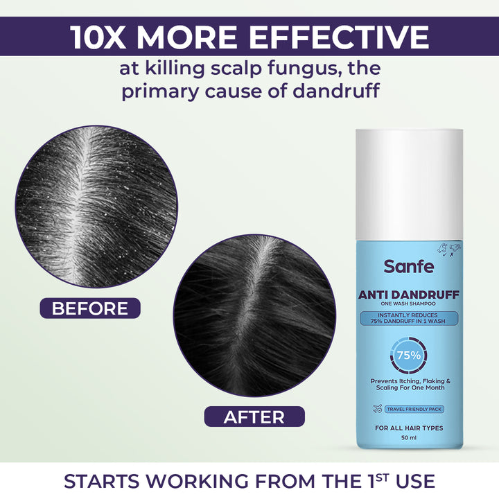 Sanfe Anti Dandruff One Wash Shampoo Removes Dandruff, Helps With Itching & Irritation 50ml