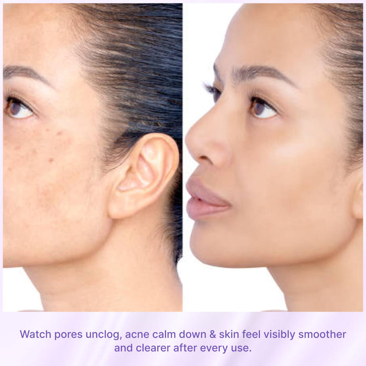 3-Step Clear Skin Combo