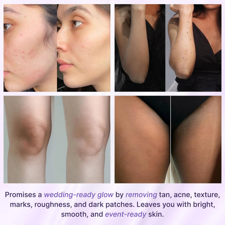 30 Days Wedding Season Body Detan Kit