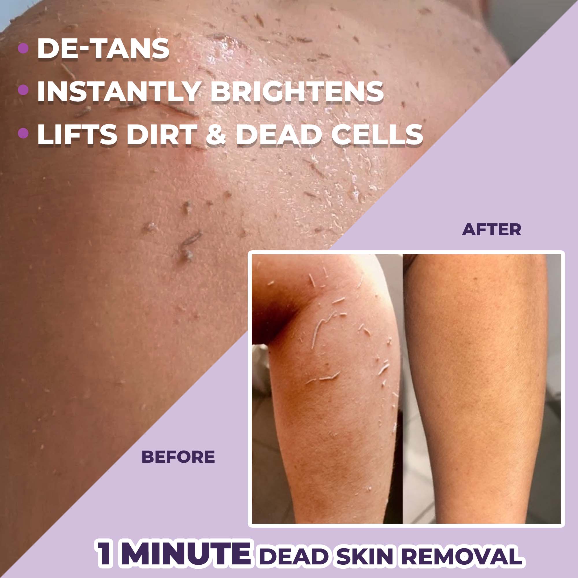 Dead skin removal deals body