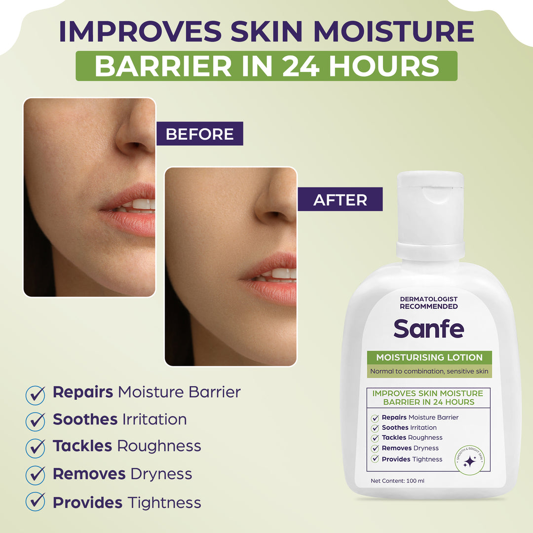 Sanfe Moisturizing Lotion - 100ml