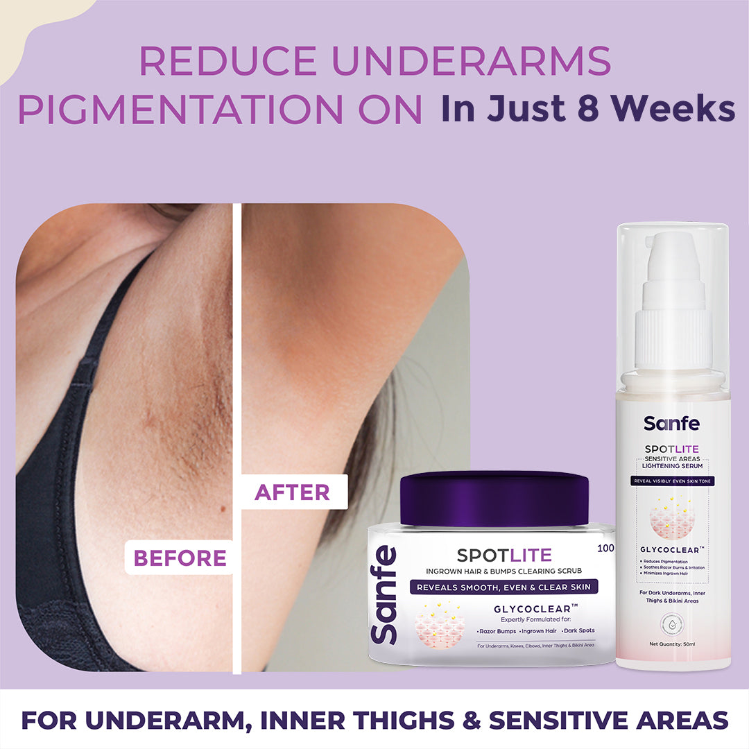 Spotlite Bikini Underarms Care Kit - Main Image