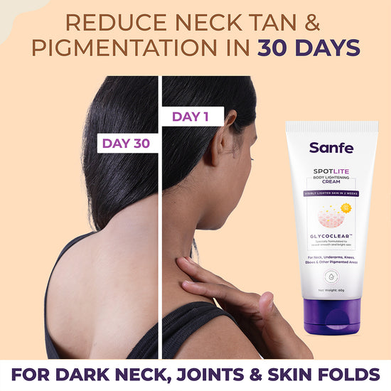 Sanfe Spotlite Complete Body Lightening Combo | For Dark Neck, Underarms, Inner Thighs, Joints | 3X Quicker Penetration with Glycodeep Technology | 2 Step Body Care Routine for women - Glo Cream and Spotlite Sensitive Areas Serum 110gm