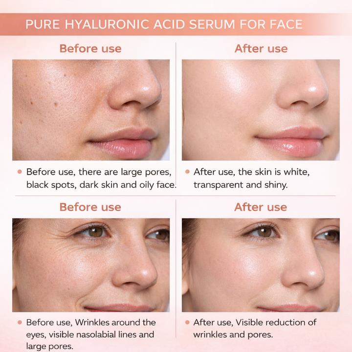 Sanfe FibraLift Instant Soluble Collagen Threads