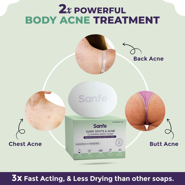 Sanfe Dark Spot Acne Clearing Soap