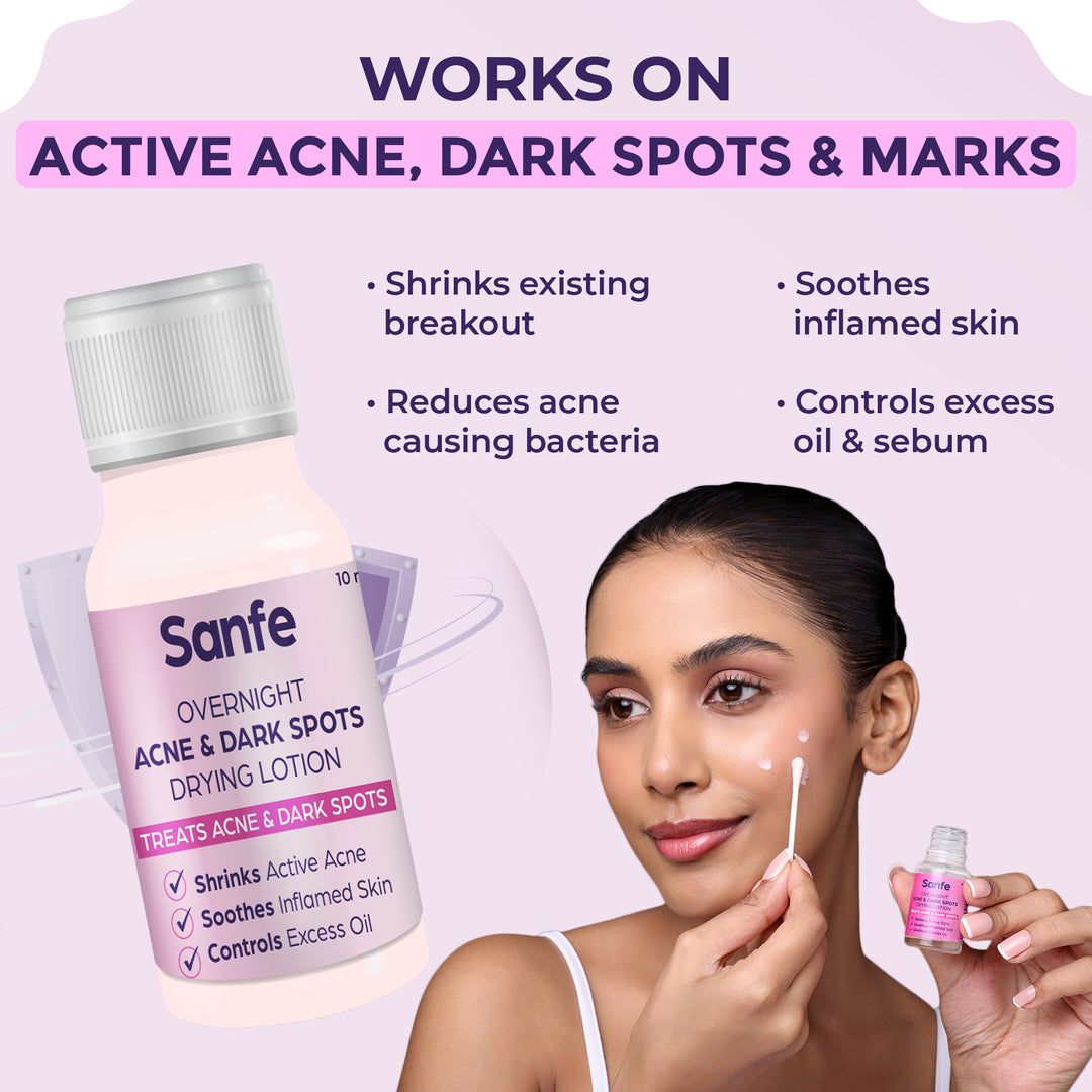 Sanfe Overnight Acne & Dark Spots Drying Lotion - 10ml