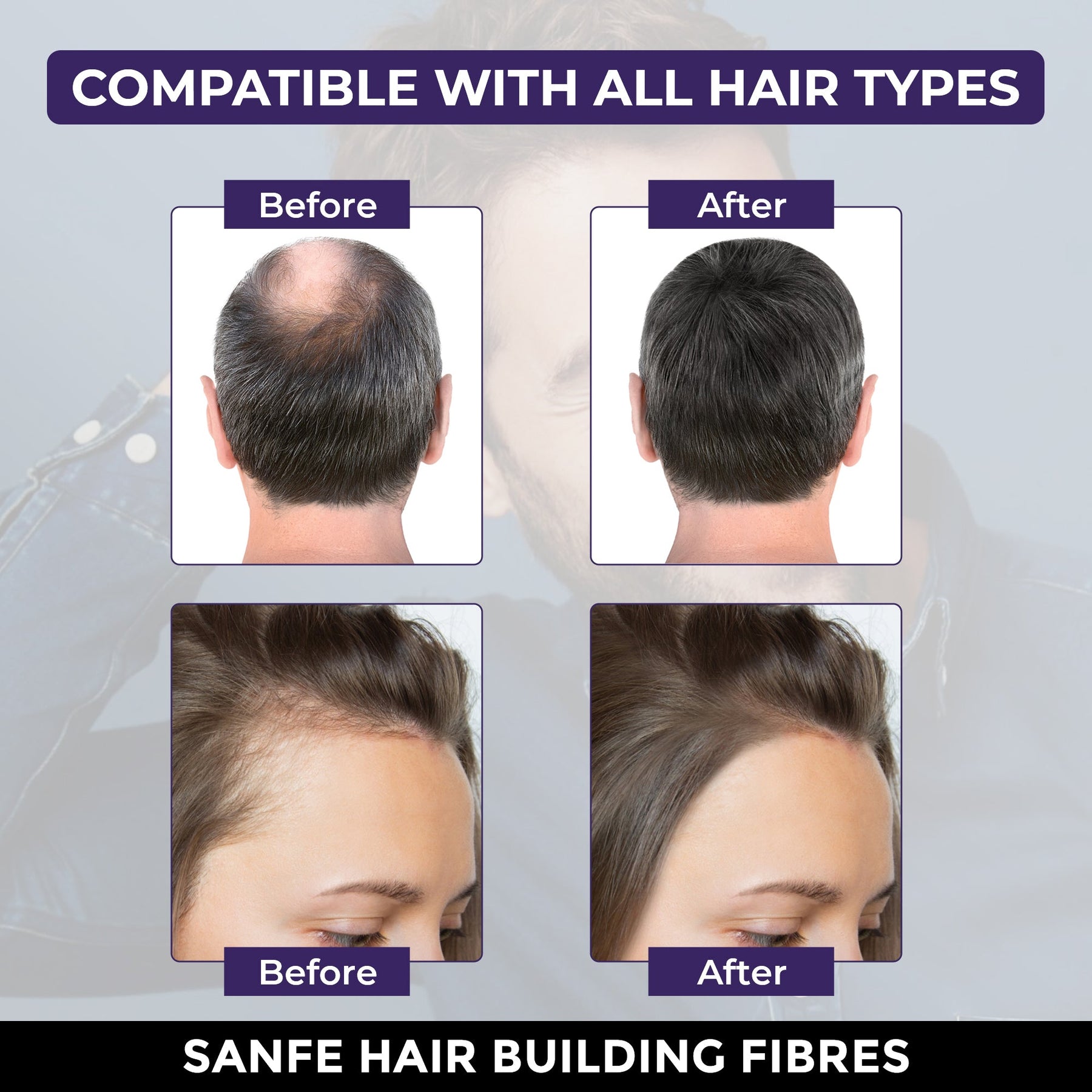 Sanfe Instant Bald Spot Covering Fibers 22gm Black