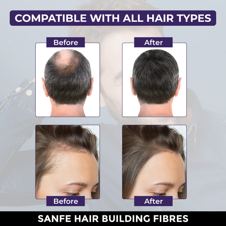 Sanfe Instant Bald Spot Covering Fibers 22gm - Black