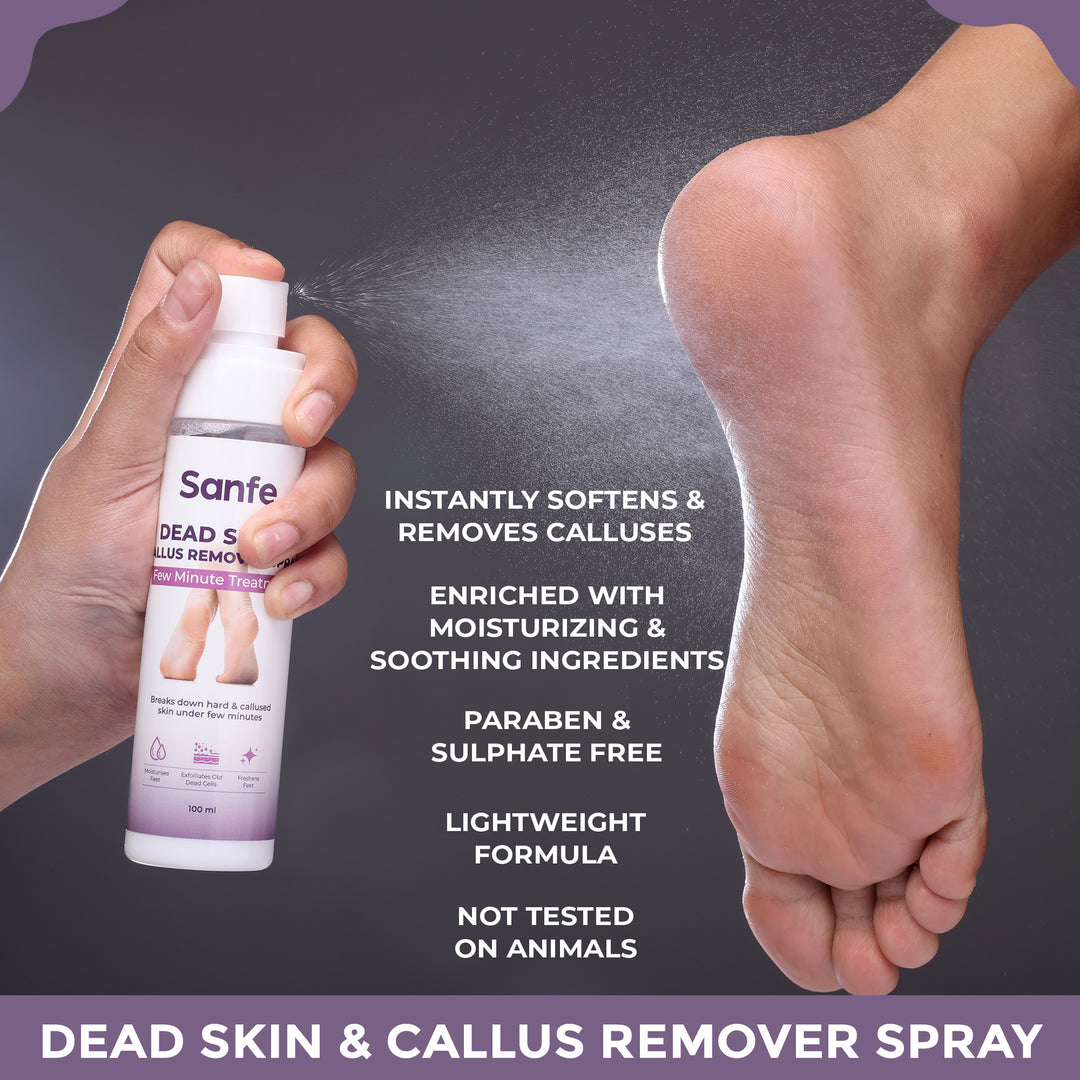 Sanfe Dead Skin & Callus Remover Spray - 100ml