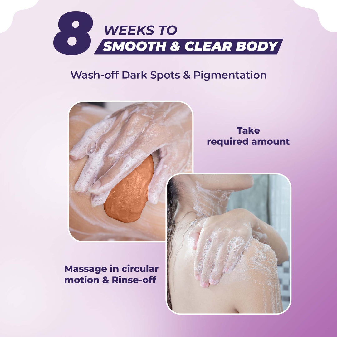 Dark Patches Removal Soap