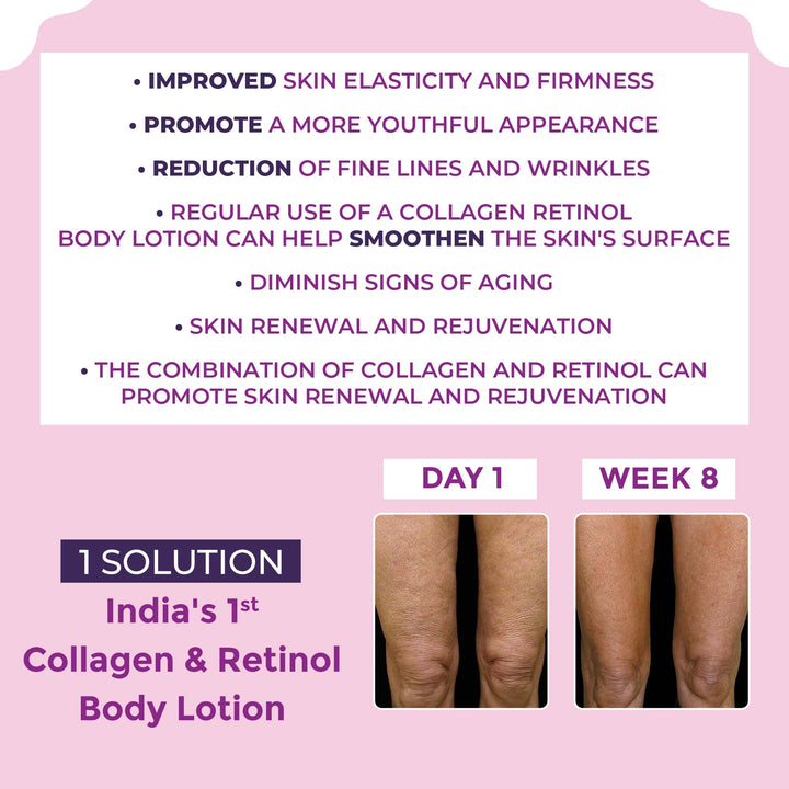 Sanfe Collagen Retinol Body Lotion - 200ml
