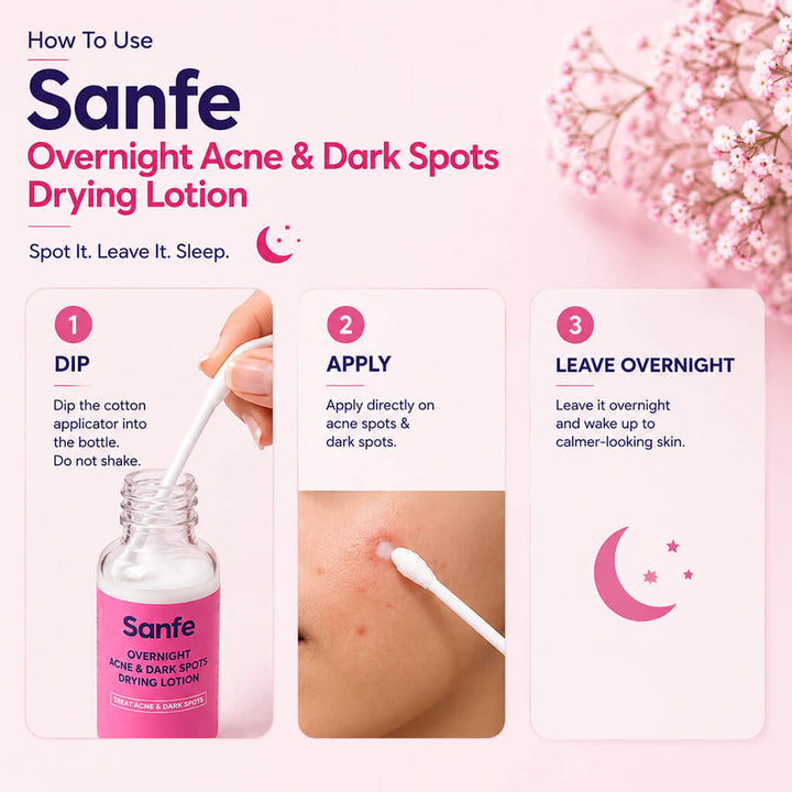 Sanfe Overnight Acne & Dark Spots Drying Lotion - 10ml