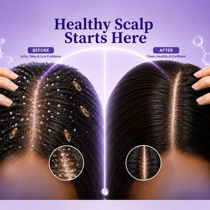 Sanfe Complete Lice & Dandruff Control Kit | Shampoo + 3-in-1 Hair Comb