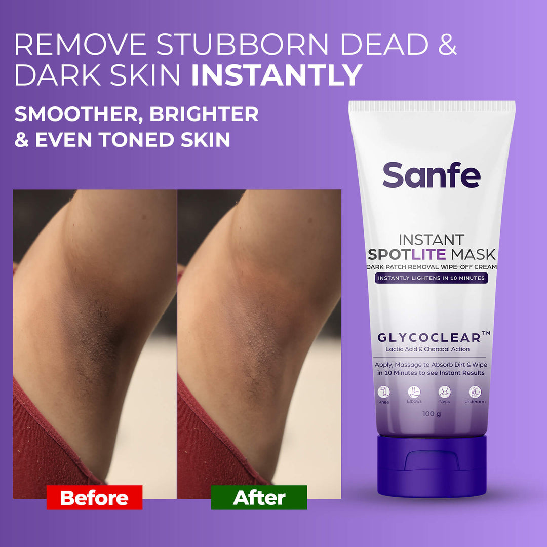Instant Spotlite Mask For Dark Patches (Pack of 3)