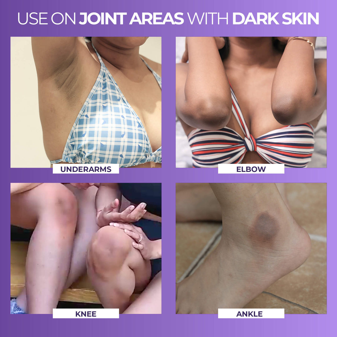 Instant Spotlite Mask For Dark Patches (Pack of 3)