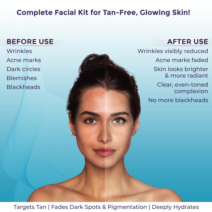 Sanfe Insta Facial Kit | 5-Step Facial Magic for Oily, Dull & Tanned Skin