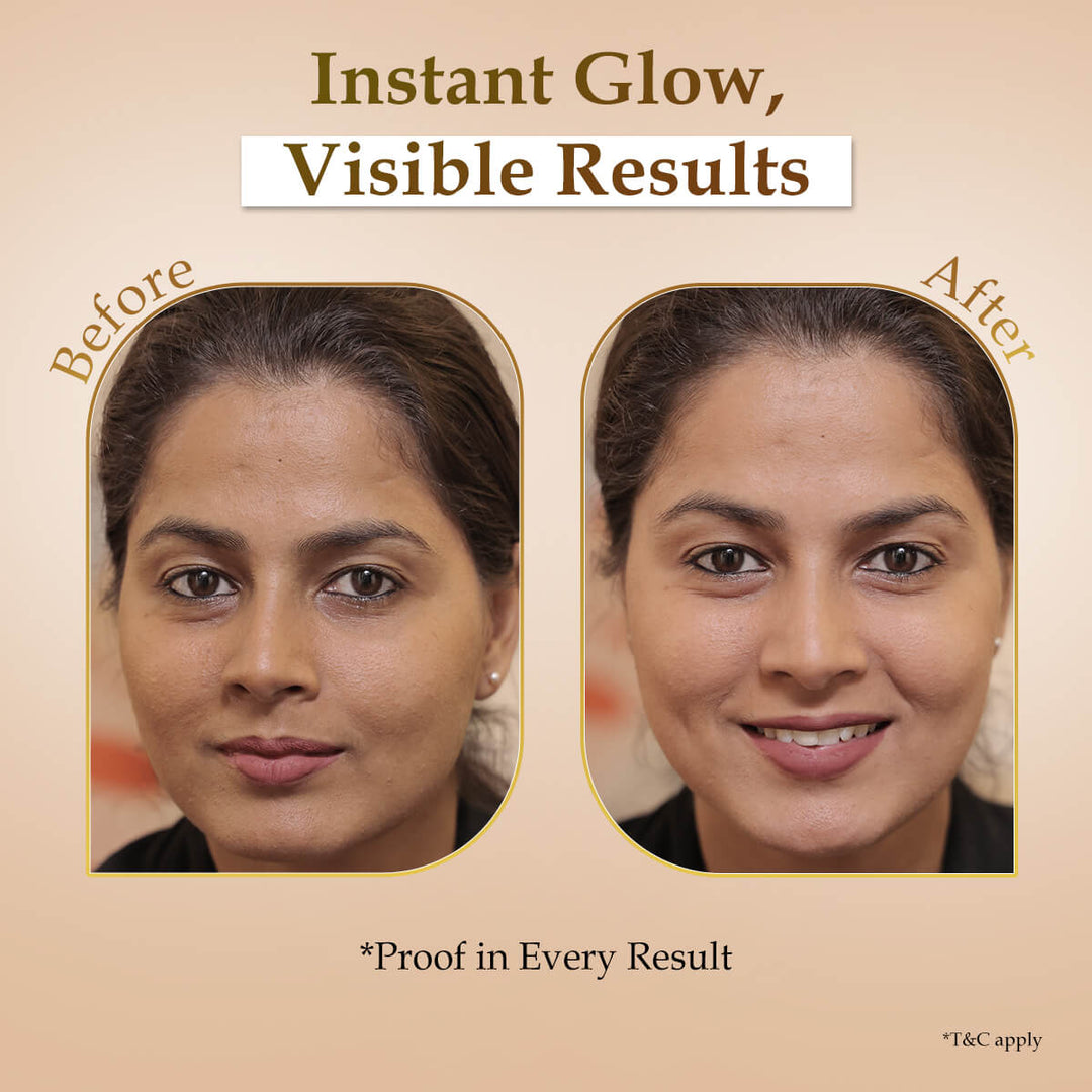 Rice Water Facial Mask (Pack of 6)