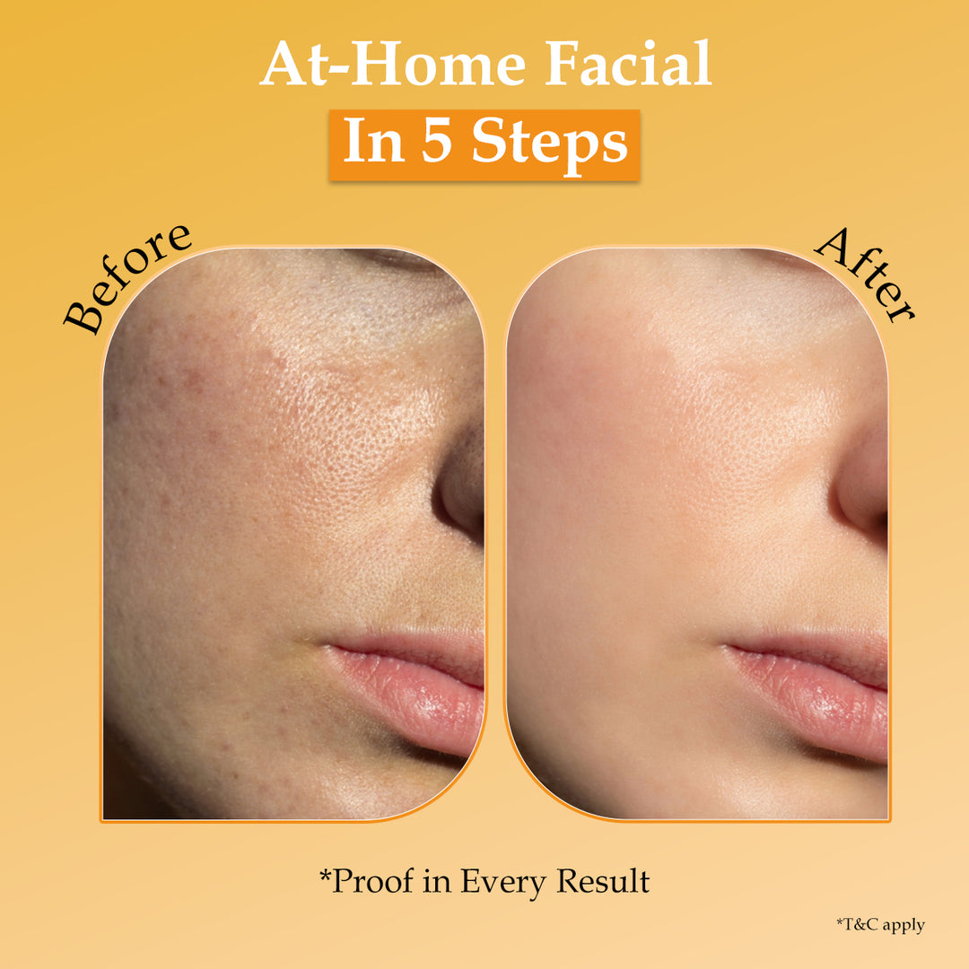 Tan Erase™ Instant Body D-Tan Kit