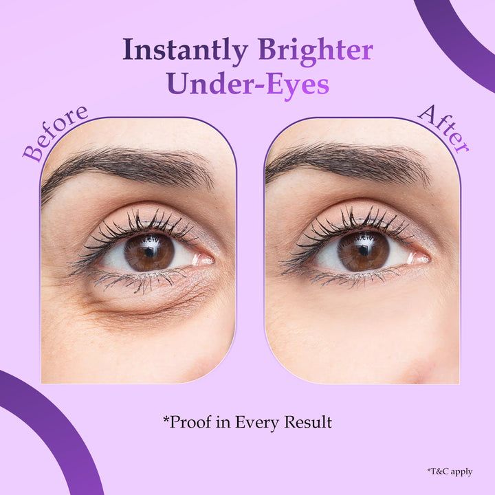 Sanfe DermaLift Under Eye Therapy Patches