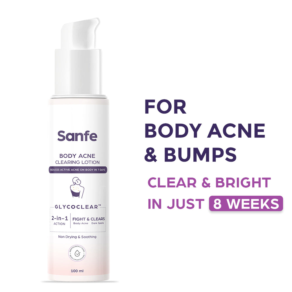 Sanfe Body Acne Clearing Lotion 100ml