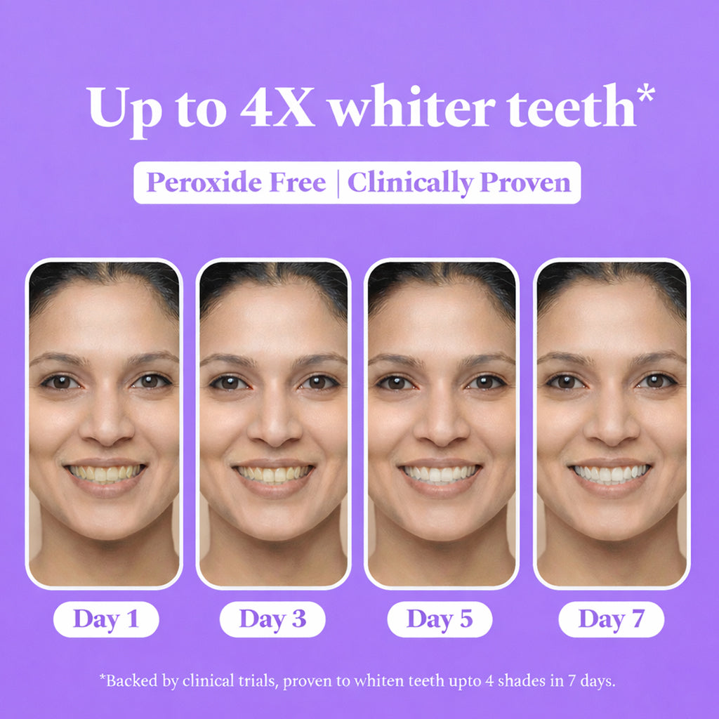 Sanfe Teeth Whitening Strips - 14 Pairs, For men & women