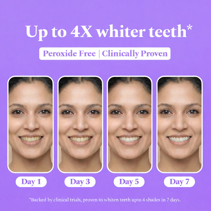Sanfe Teeth Whitening Strips - 14 Pairs, For men & women