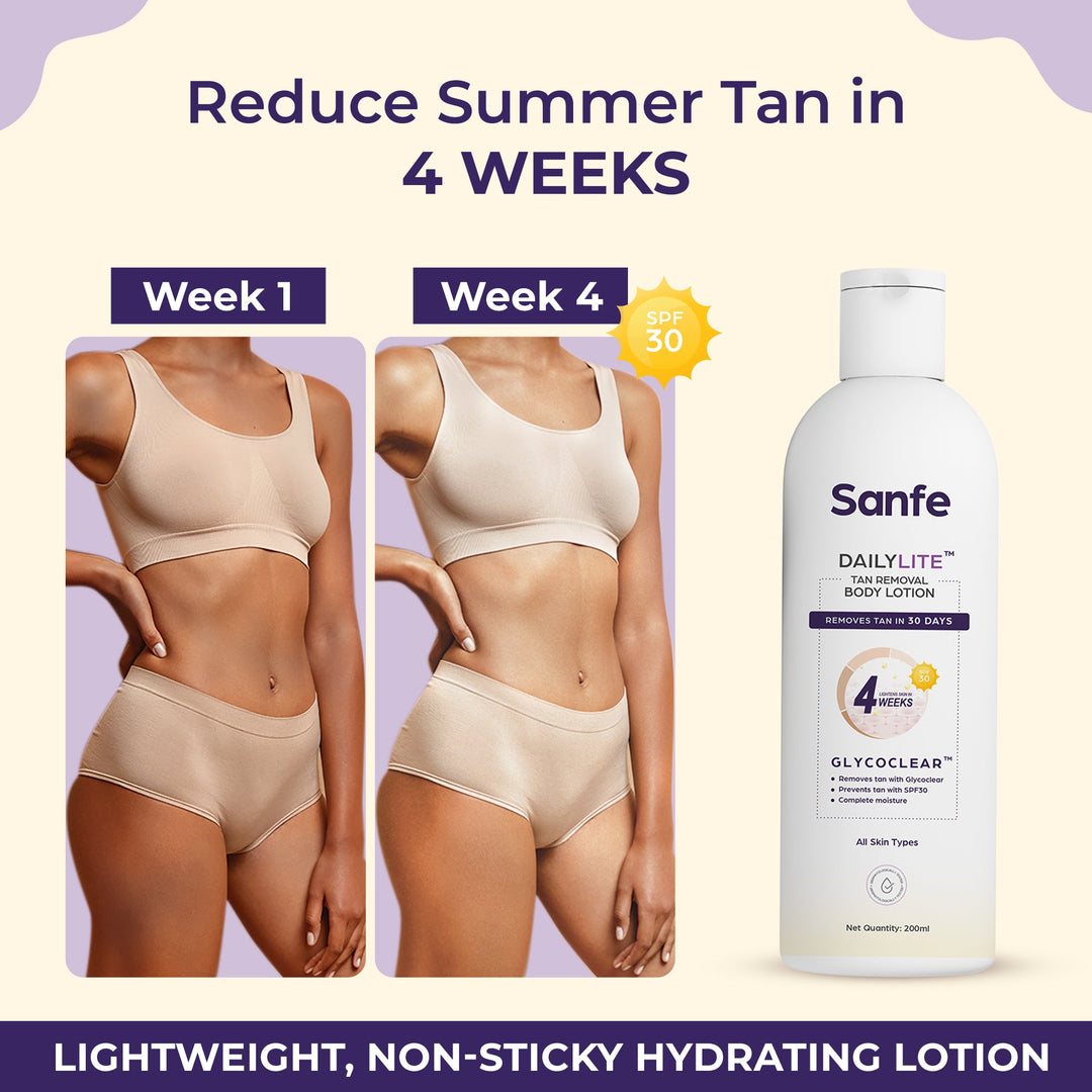 Sanfe DailyLite Tan Removal Body Lotion| Detan | Non-sticky| Removes & Prevents Tan| SPF 30 ||Results in 4 weeks| 200ml