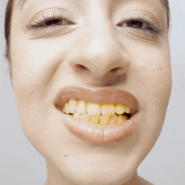Purple Teeth Whitening Gel