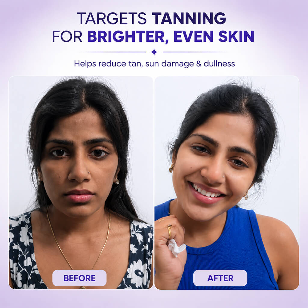 Sanfe Instant Tan & Dead Skin Removal Exfoliating Gel 200g (Pack of 3)