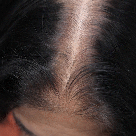 Sanfe Hairline & Gray Concealer Touch Up Powder