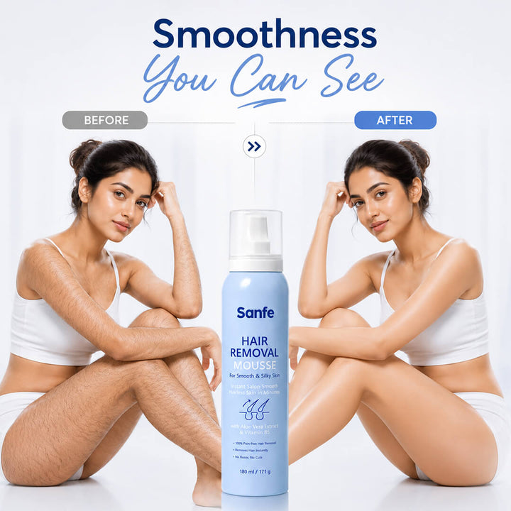 Sanfe Hair Removal Mousse for Silky and Smooth Skin